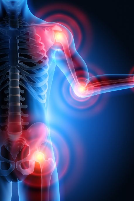 inflammation